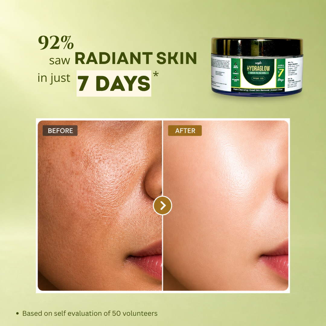 Aegte Hydra Glow Skin Renewal Magic Gel | Deep Pore Cleansing & Exfoliation | Dead Skin Removal 50gm