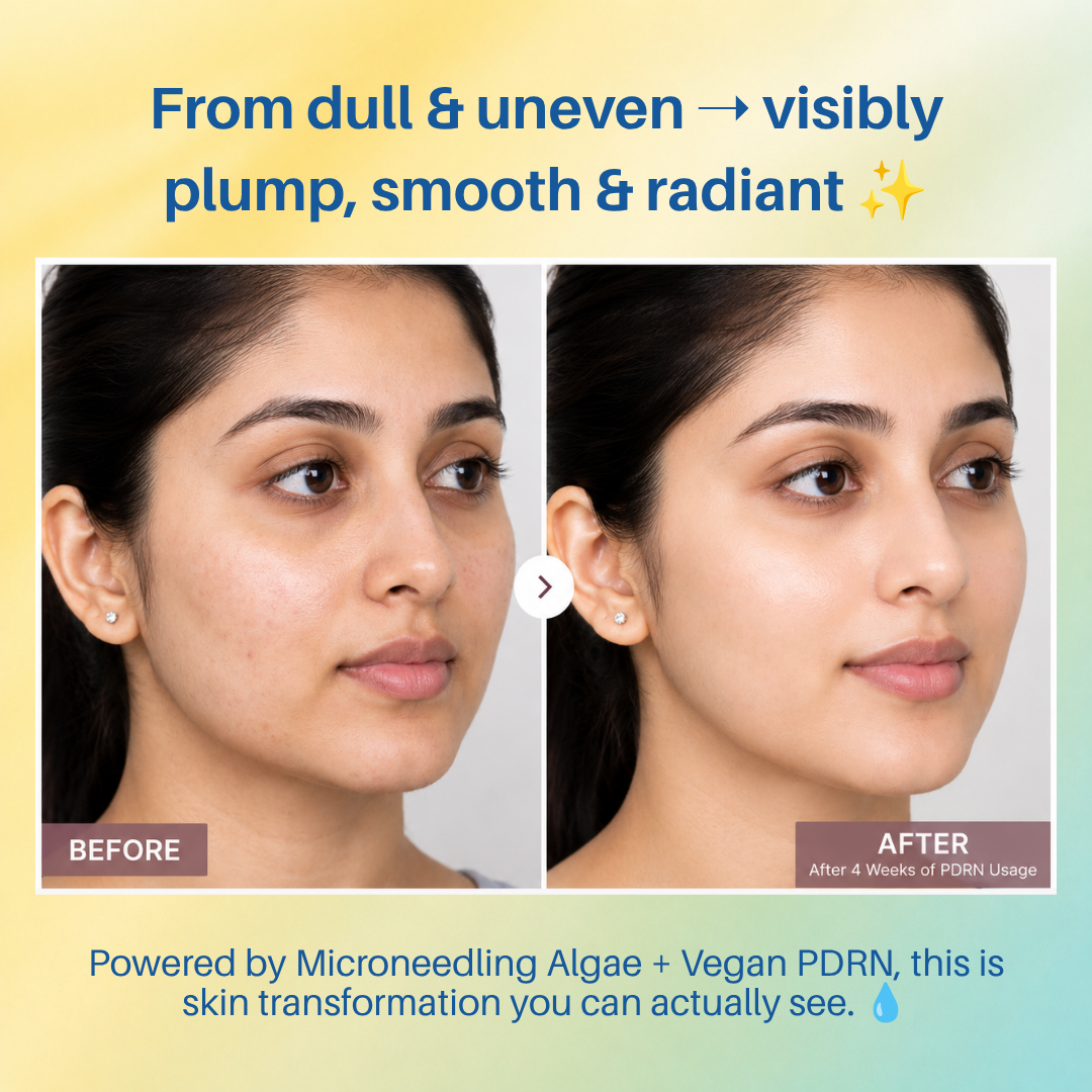 Aegte Hylu-Collagen Advanced Skin Booster With Microneedling Algae & Vegan PDRN