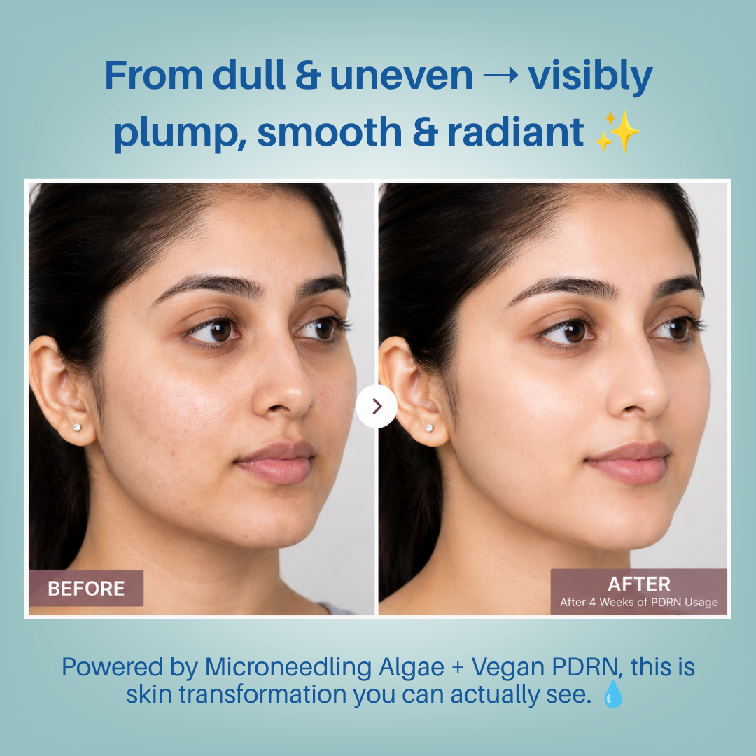 Aegte Hylu-Collagen Advanced Skin Booster With Microneedling Algae & Vegan PDRN