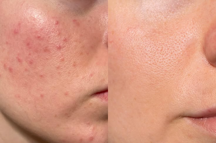 Why Does Your Face Still Look Dull After Skincare?